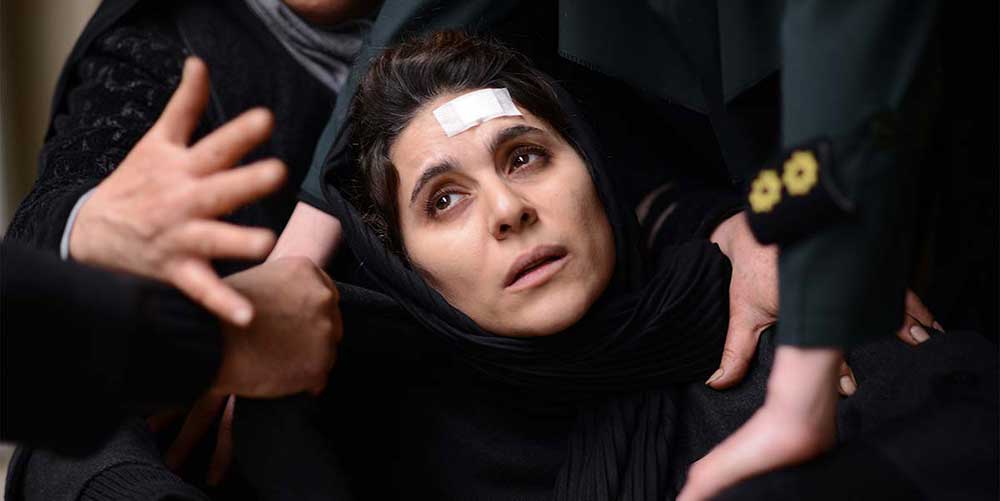 A closeup of Sahar Dolatshahi as Sara with a bandage on her head.