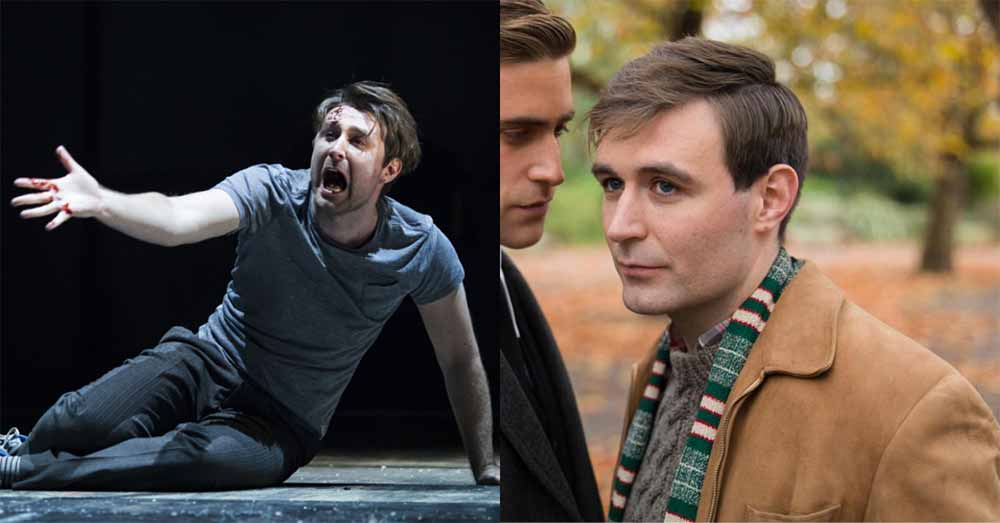 James McArdle is one of the most exciting emerging actors working today.